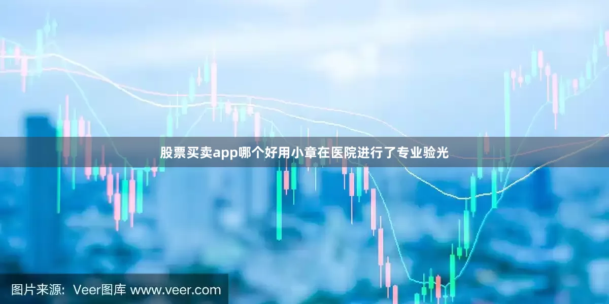 股票买卖app哪个好用小章在医院进行了专业验光